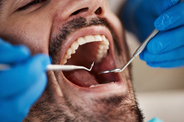 Best Knocked-Out Tooth Emergency  in South Carthage, TN