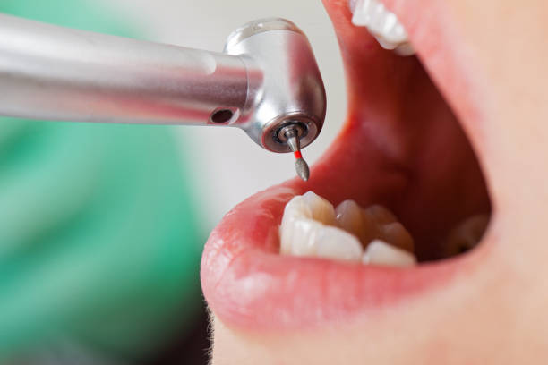Best Cracked Tooth Emergency Dentist  in South Carthage, TN